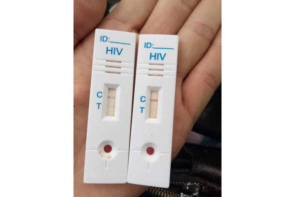 hiv试纸两条杠图片