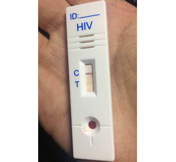 hiv试纸t线非常淡图片